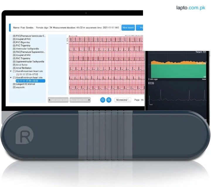 Wellue AI ECG Monitor - Holter Monitor 24 Hours | Wireless EKG Monitoring Devices | Compatible with iPhone & Android, Mac & Windows